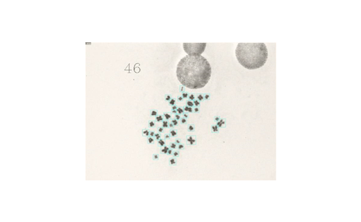 Chromosome Detection System Using Deep-Learning Technique for Radiation Exposure